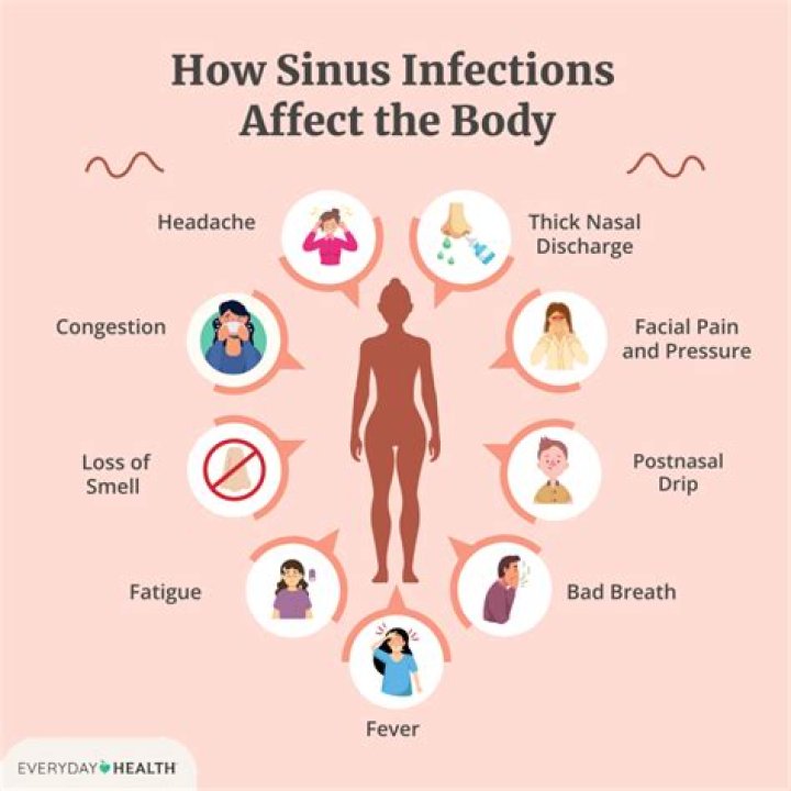 Can a sinus infection cause endocarditis?