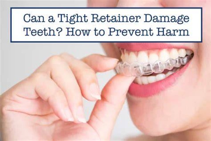 Can a tight retainer damage teeth?