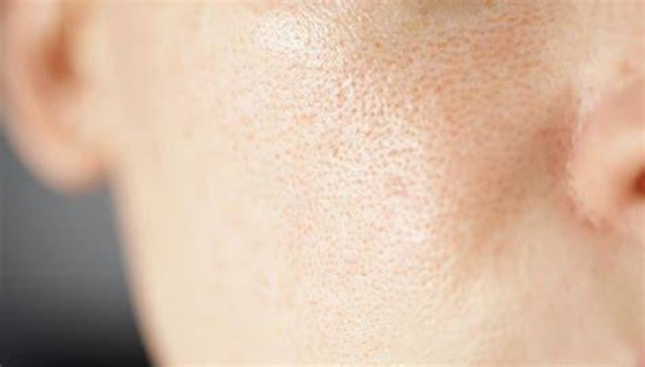 Can aloe vera close pores?