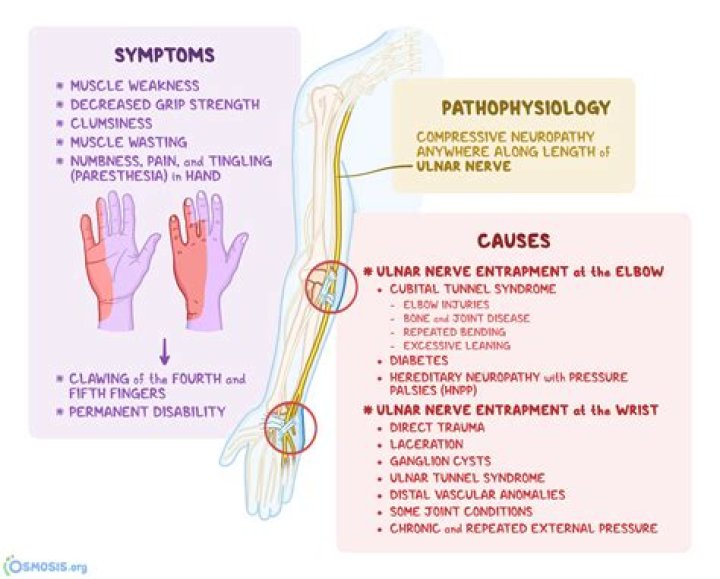 Can an orthopedic treat nerve damage?