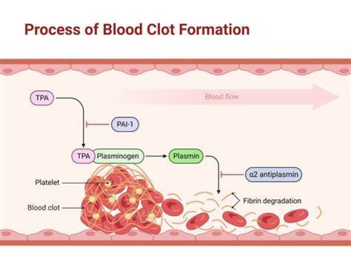 Can blood clot go away on its own?