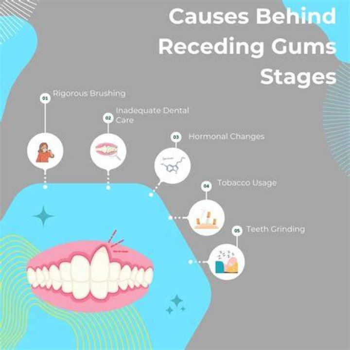 Can braces cause receding gums?