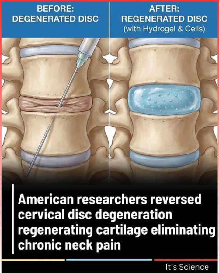 Can cartilage be regenerated?