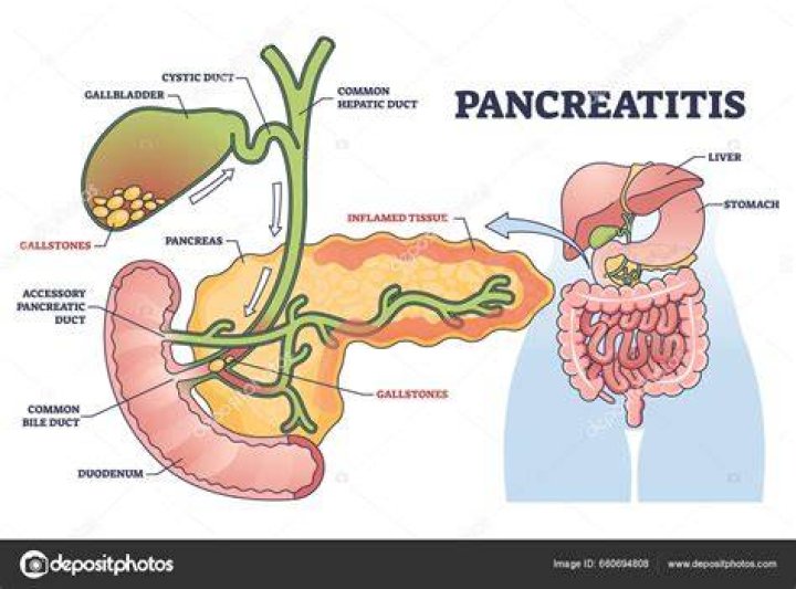 Can dehydration affect pancreas?