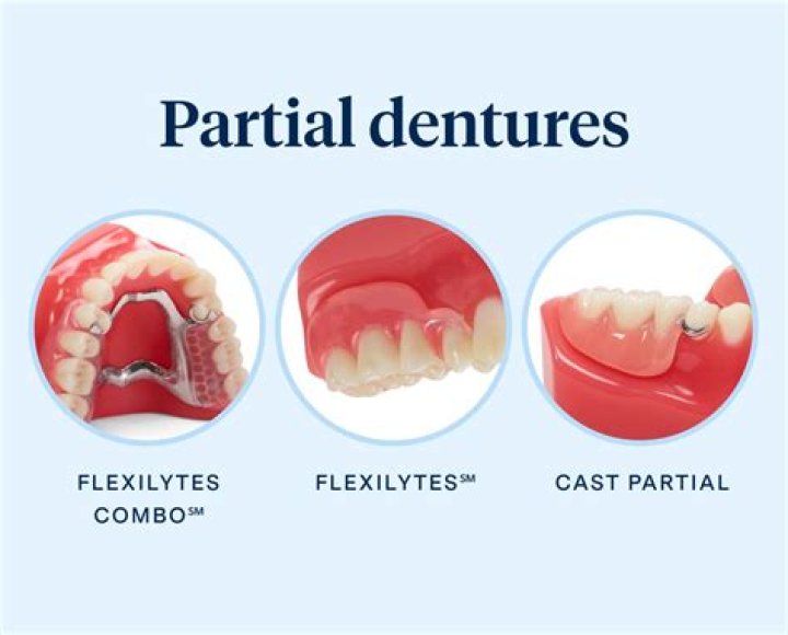 Can dentures make you look better?