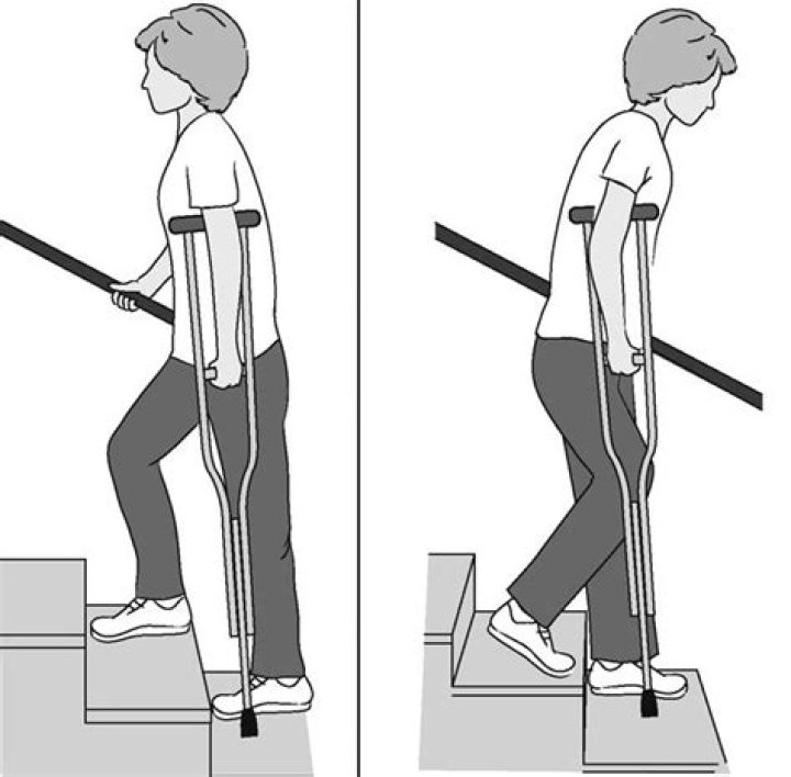 Can I climb stairs after hip surgery?