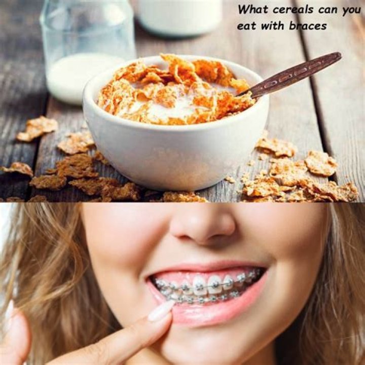 Can I eat an orange with braces?