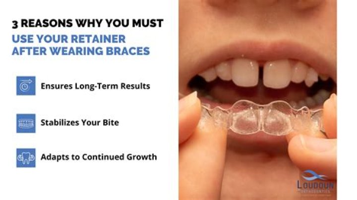 Can I eat with retainers on?