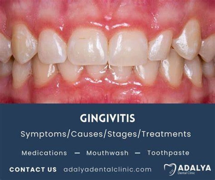 Can I reverse gingivitis on my own?
