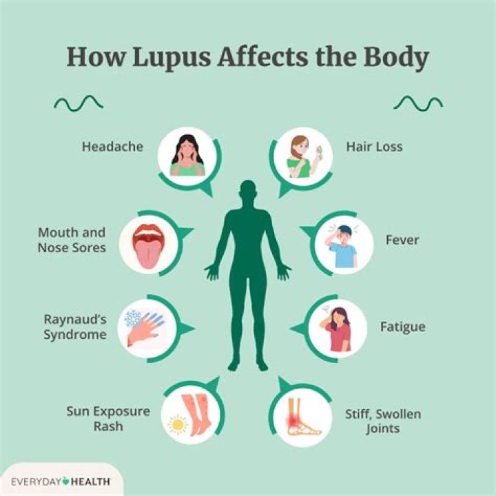 Can lupus affect your hips?