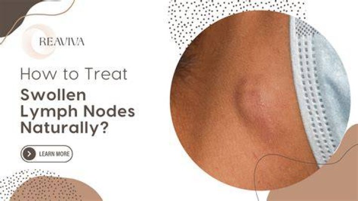 Can one swollen lymph node be lymphoma?