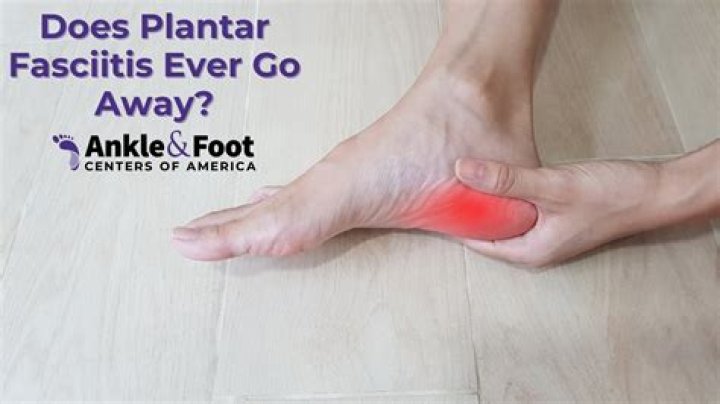 Can plantar fasciitis go away quickly?