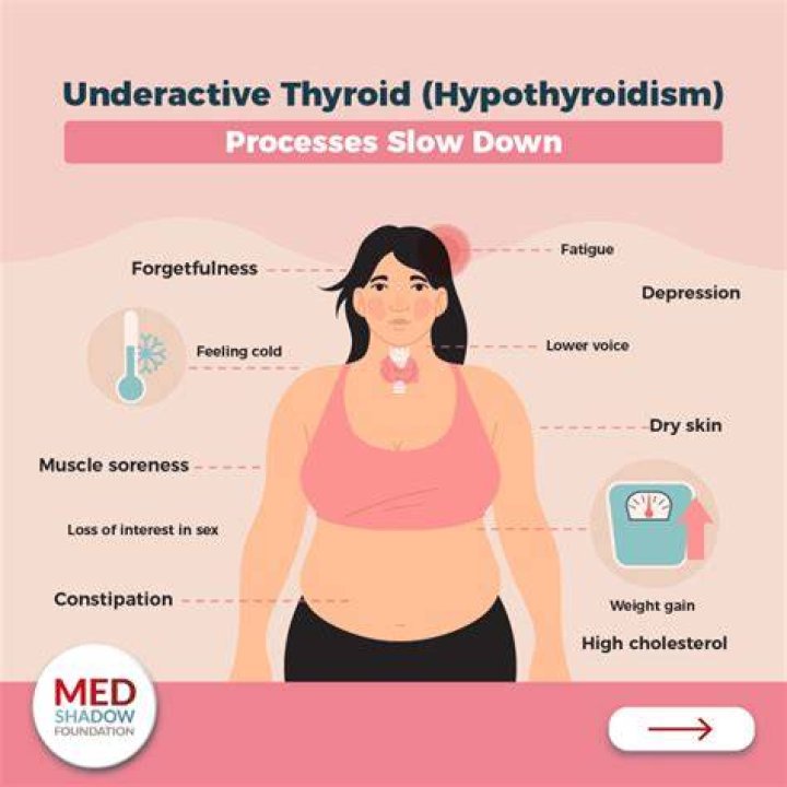 Can untreated hypothyroidism cause heart problems?