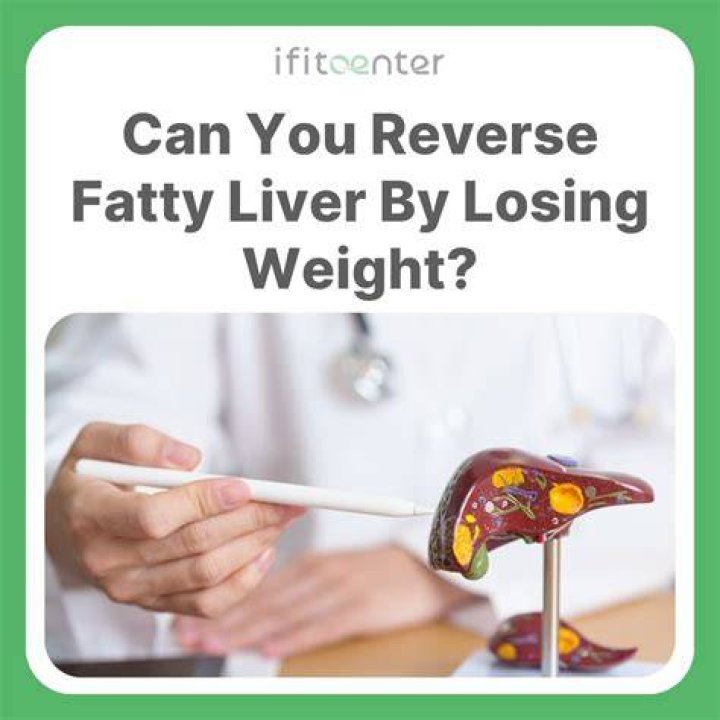 Can walking reverse fatty liver?