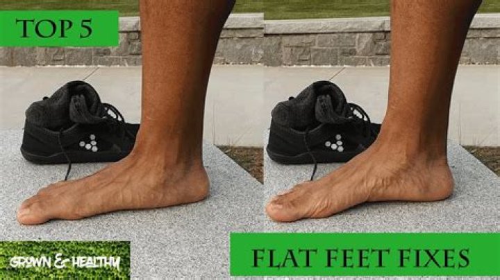 Can wide feet be fixed?