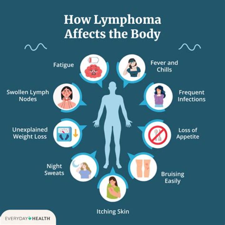 Can you be completely cured of lymphoma?