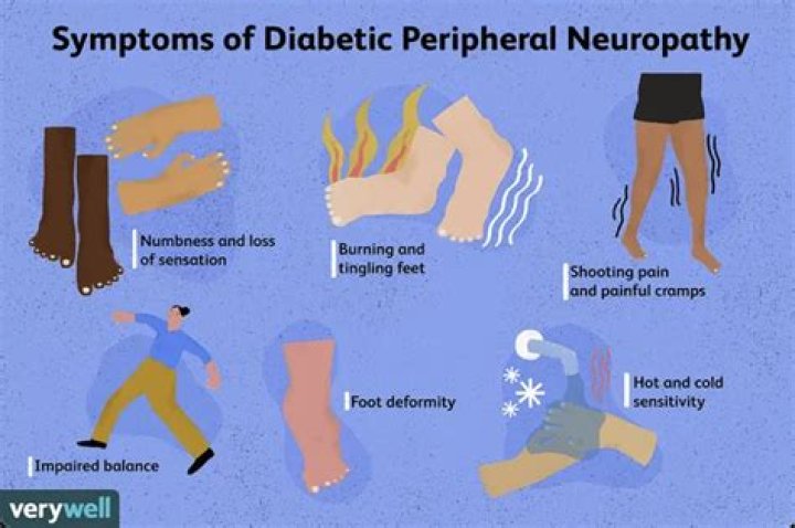 Can you have neuropathy without being diabetic?