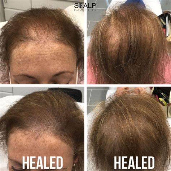 Can you see scalp through hair?