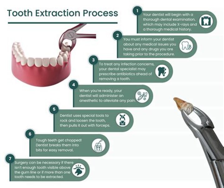 Can you talk after tooth extraction?