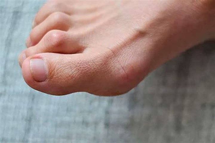 Can you wiggle your toes if you break your ankle?