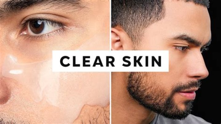 Do all models have clear skin?