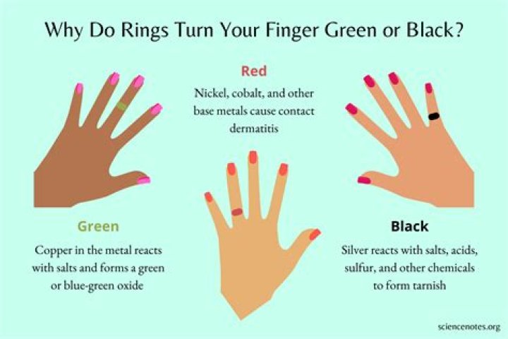 Do Pandora rings turn green?