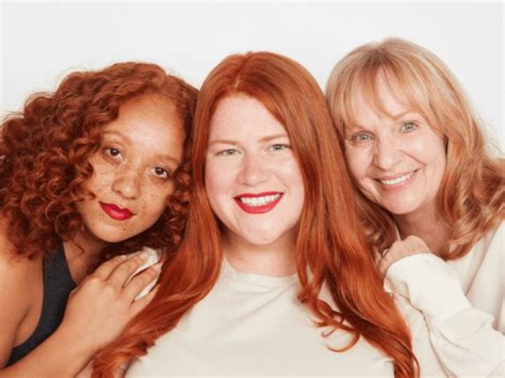 Do redheads get cold easy?