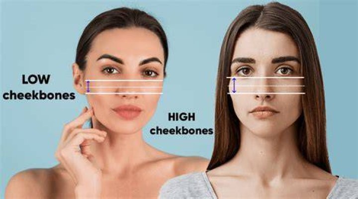 Do teeth affect cheekbones?