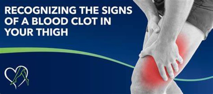 Does a blood clot in the leg hurt constantly?