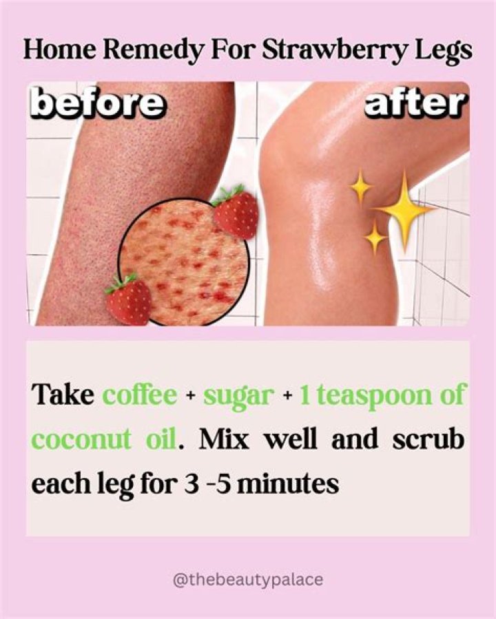 Does baby oil stop strawberry legs?