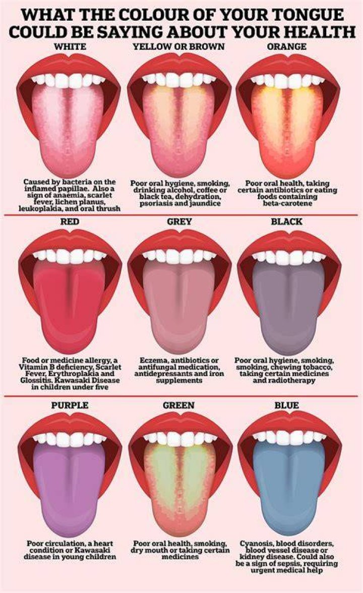 Does Covid turn your tongue blue?