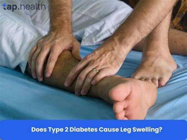 Does diabetes cause heavy legs?