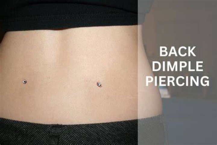 Does dimple come back?