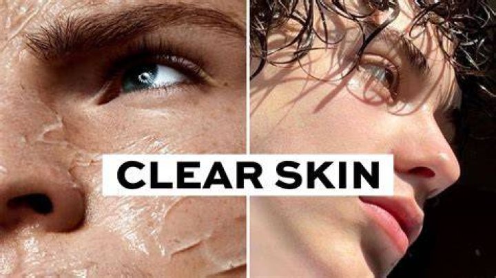 Does exercising help clear skin?