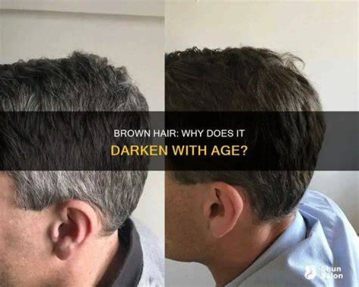 Does gold get darker with age?