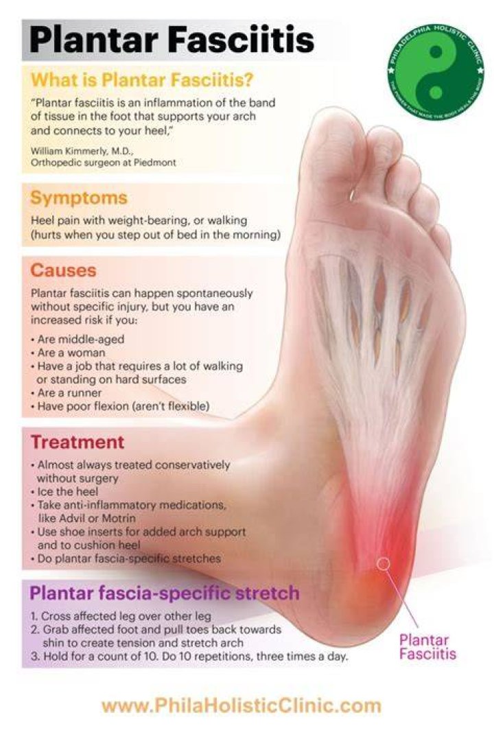Does heat make plantar fasciitis worse?