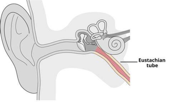 Does hydrogen peroxide clear Eustachian tubes?