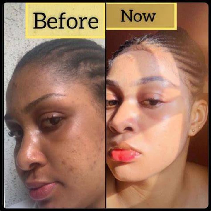 Does jojoba lighten skin?