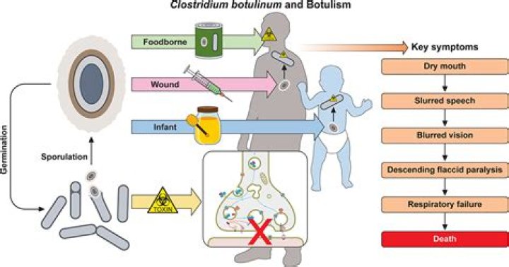 Does pectin prevent botulism?