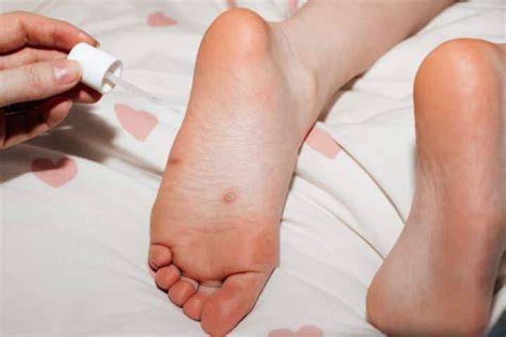 Does peeing on your feet stop them smelling?