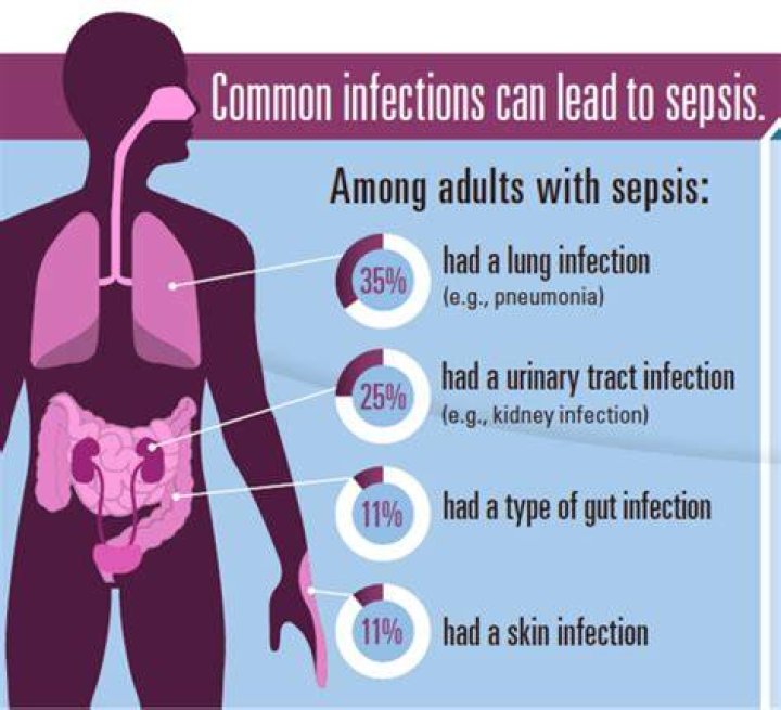Does sepsis always have a fever?