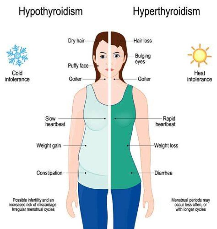 Does thyroid eye disease go away?