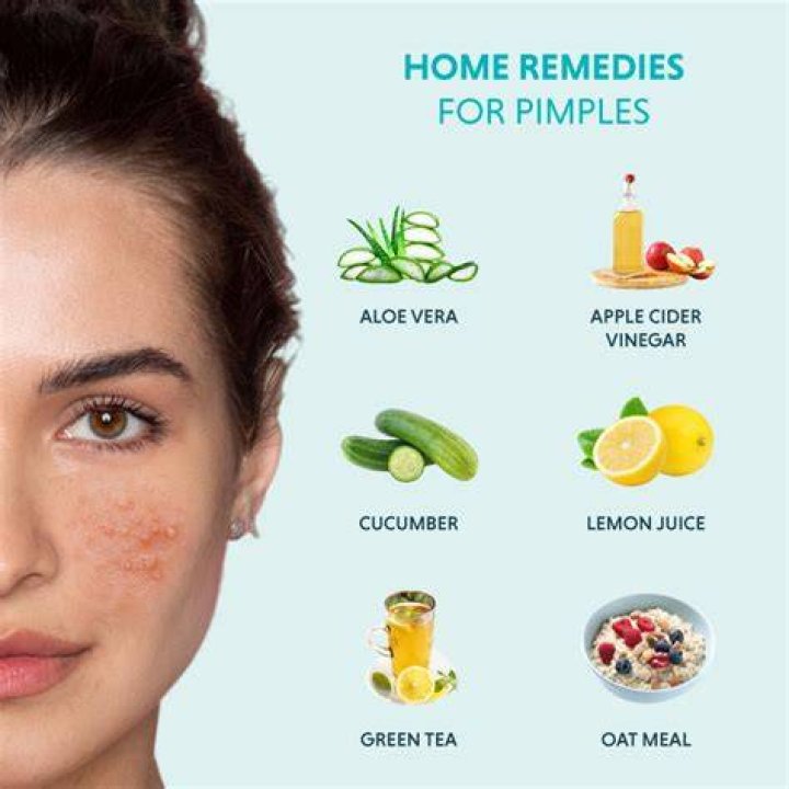 How can I stop having pimples on my face?