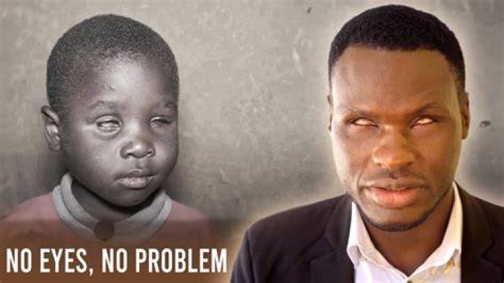 How can you be born without eyes?