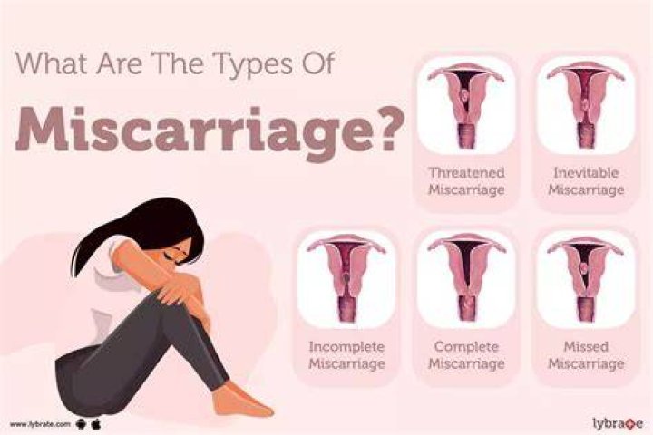 How common is a missed miscarriage?