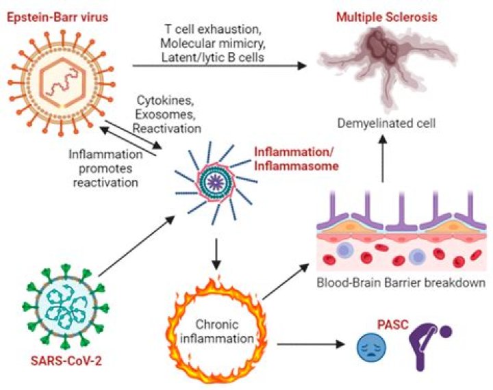 How did I get Epstein-Barr virus?