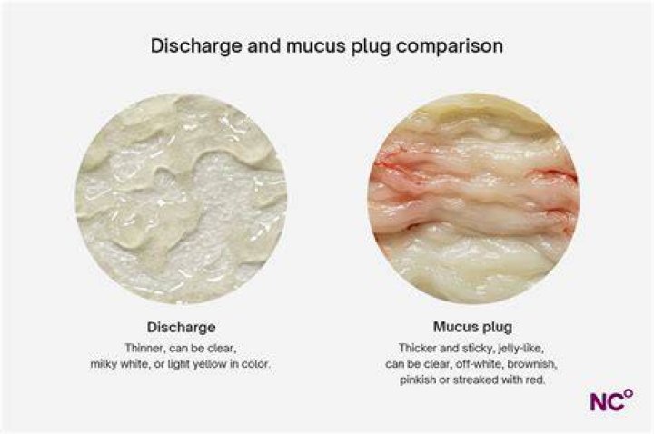 How dilated do you have to be to lose your mucus plug?