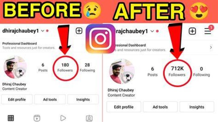 How do I get 20000 followers on Instagram?