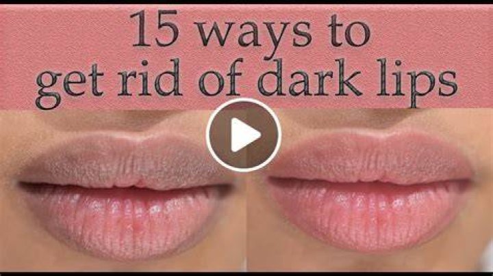 How do I get rid of dark lips permanently?
