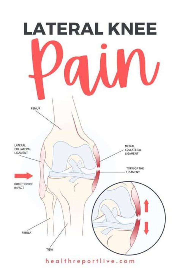 How do I know if my knee pain is serious?